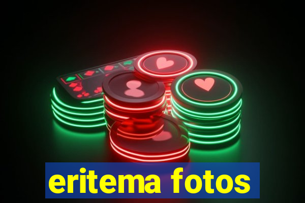 eritema fotos